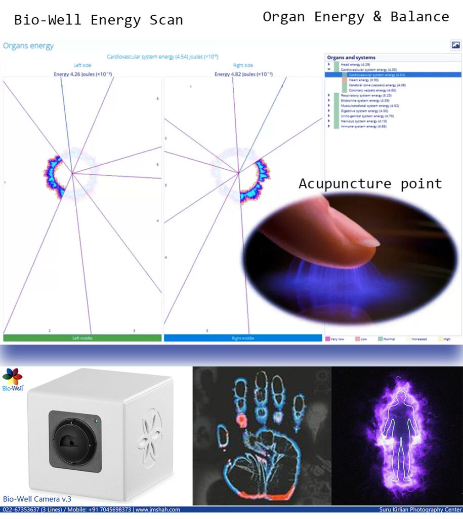 GDV Energy Field analysis